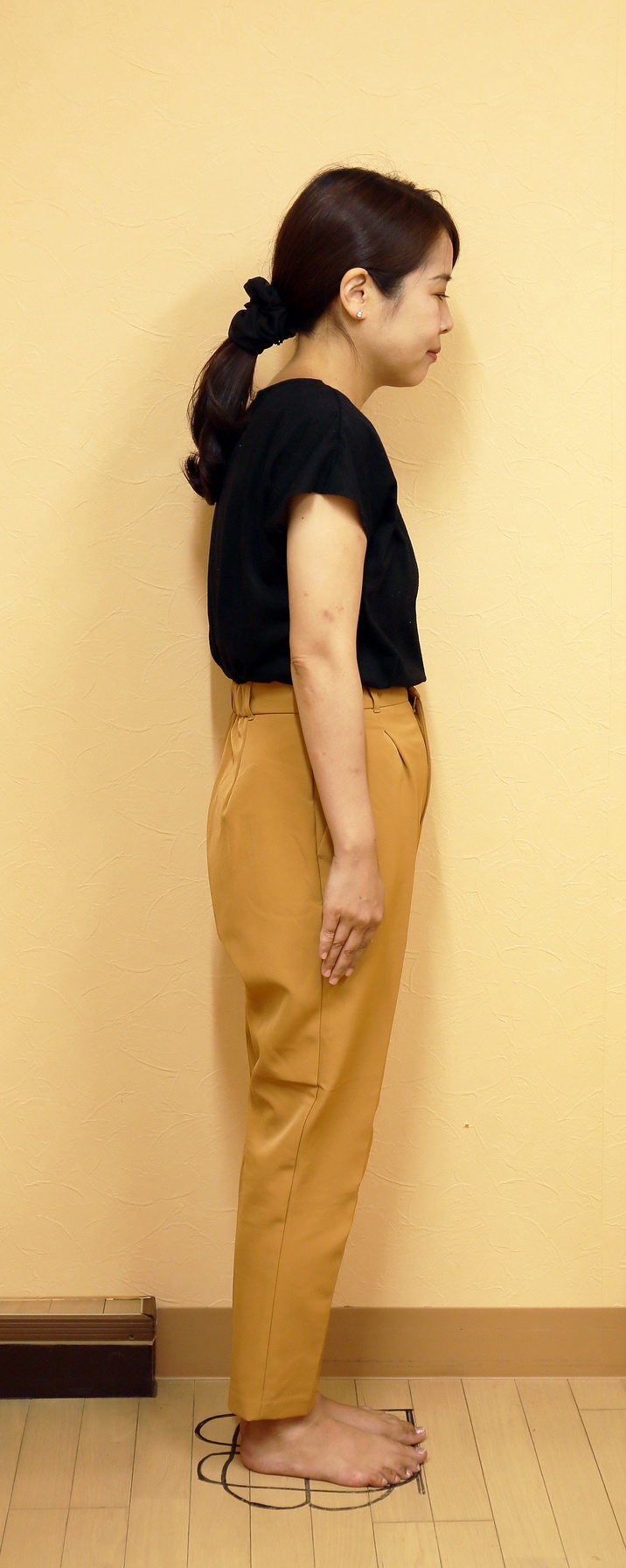 骨盤矯正　ビフォア